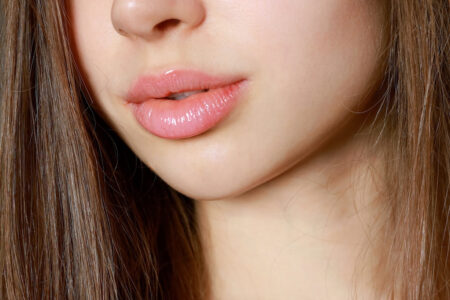 Lip Lift, czyli sposób na trwałe i naturalne powiększenie ust